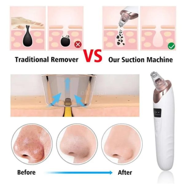 Electric Blackhead Remover Vacuum – Deep Pore Cleaner & Suction Tool for Face & Nose