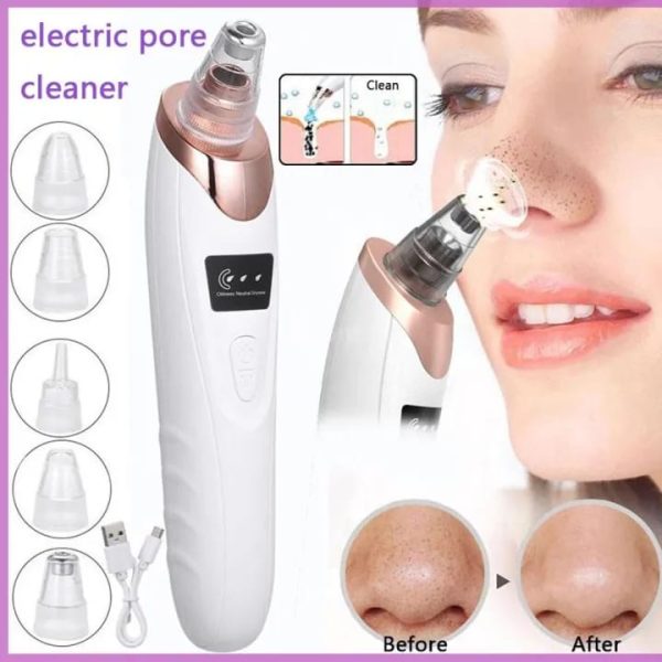 Electric Blackhead Remover Vacuum – Deep Pore Cleaner & Suction Tool for Face & Nose